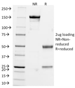 Chromogranin A Antibody (CHGA/765), Novus Biologicals 0.2mg; Unlabeled:Antibodies,